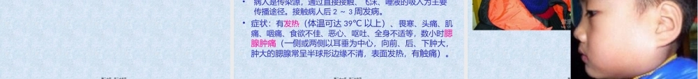 2022年医学专题—儿童常见传染病(1).pptx