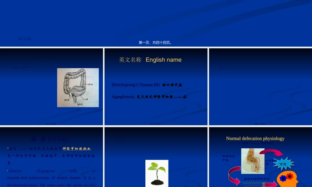 2022年医学专题—先天性巨结肠与胆道剖析(1).ppt