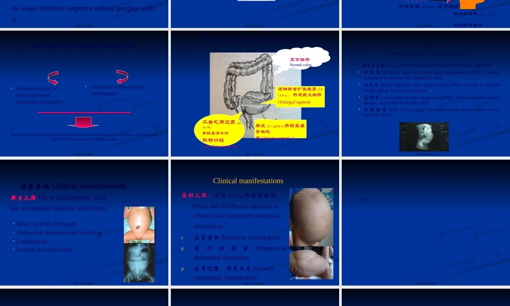2022年医学专题—先天性巨结肠与胆道剖析(1).ppt