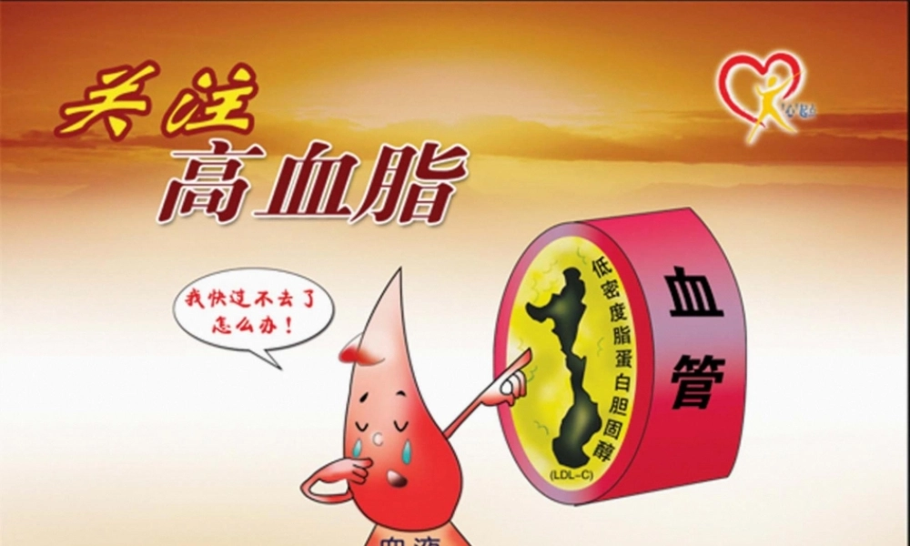 2022年医学专题—关注高血脂-最精彩的高血脂ppt(1).ppt