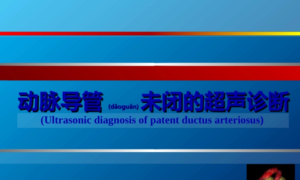 2022年医学专题—动脉导管未闭、主动脉狭窄超声(1).ppt