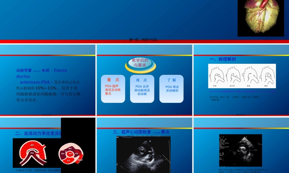 2022年医学专题—动脉导管未闭、主动脉狭窄超声(1).ppt