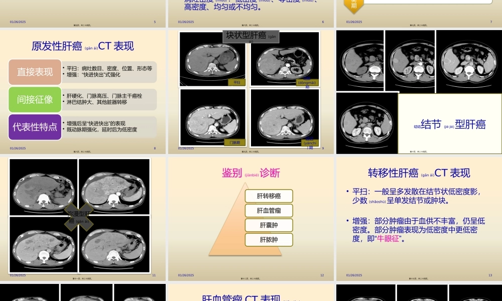 2022年医学专题—原发性肝癌CT表现与鉴别(1).pptx