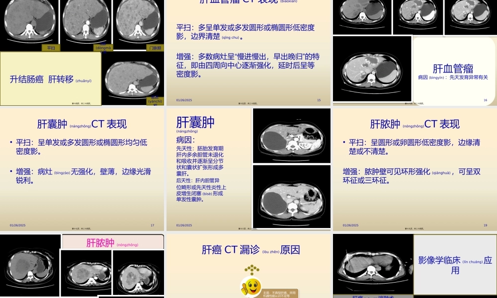 2022年医学专题—原发性肝癌CT表现与鉴别(1).pptx