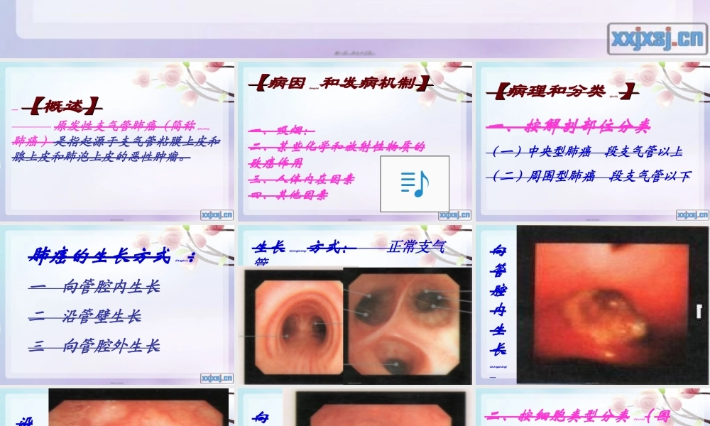 2022年医学专题—原发支气管肺癌1(1).ppt