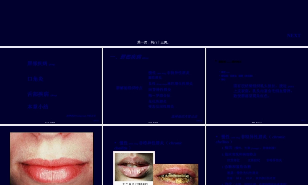 2022年医学专题—唇炎防治与健康(1).ppt