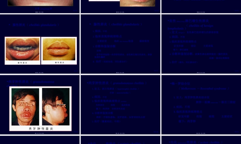 2022年医学专题—唇炎防治与健康(1).ppt