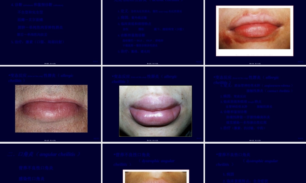 2022年医学专题—唇炎防治与健康(1).ppt