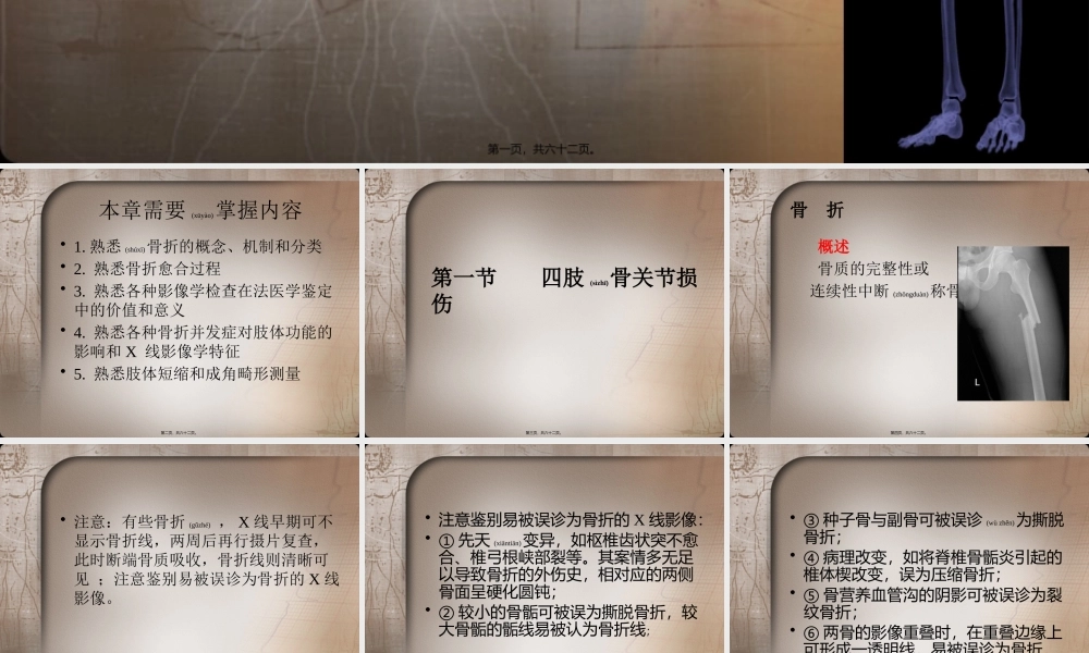 2022年医学专题—四肢骨关节损伤(1).pptx