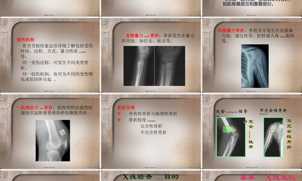 2022年医学专题—四肢骨关节损伤(1).pptx