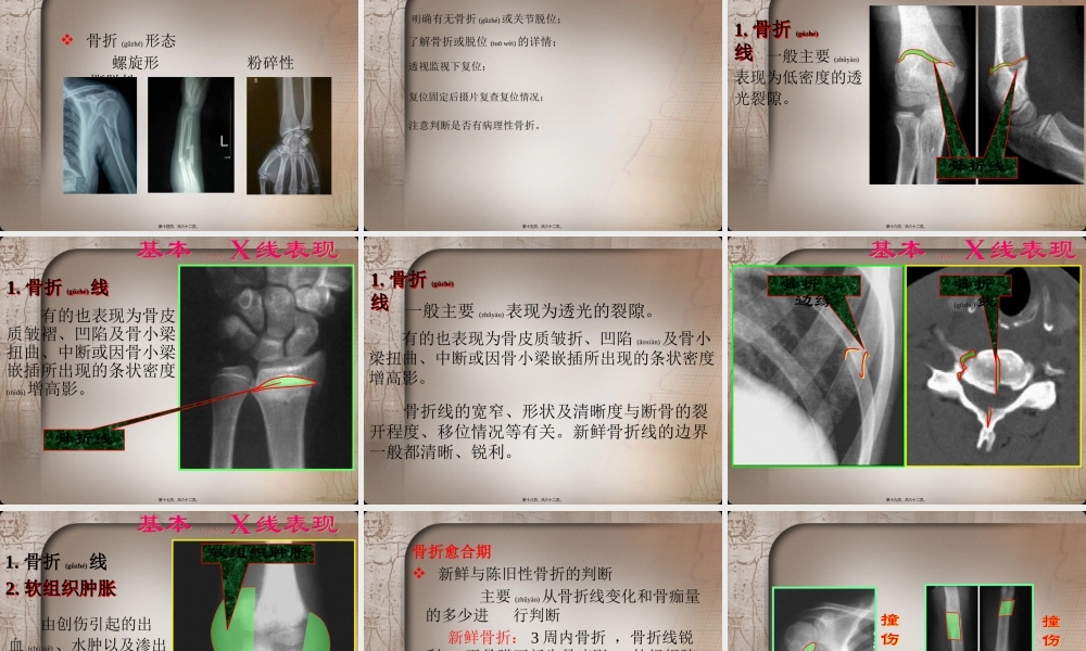 2022年医学专题—四肢骨关节损伤(1).pptx