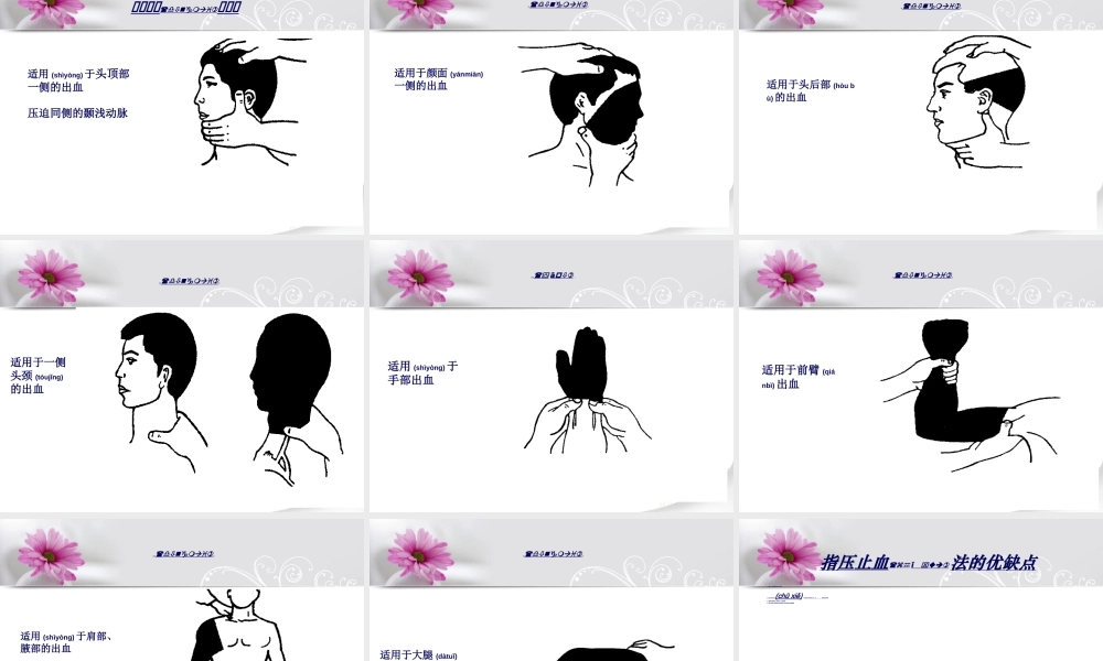 2022年医学专题—外伤的现场急救基本技术(止血).(1).ppt