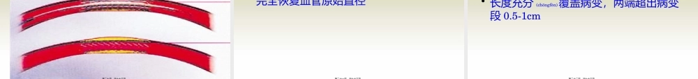 2022年医学专题—外周血管系统-(2)(1).pptx