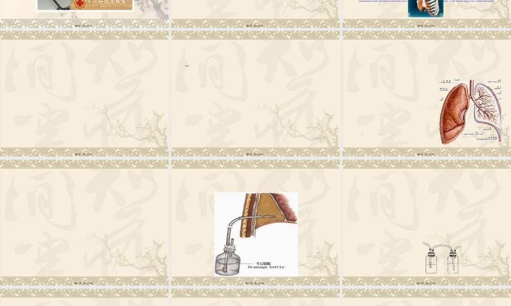 2022年医学专题—多发伤-颈半脱位讲诉(1).ppt