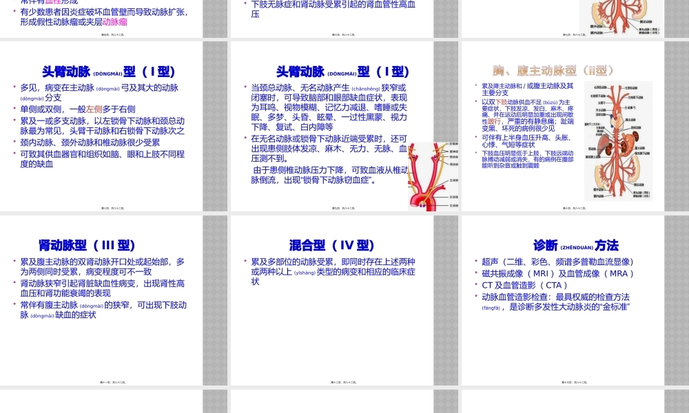 2022年医学专题—多发性大动脉炎(1).pptx