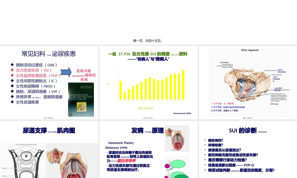 2022年医学专题—女性压力性尿失禁(1).pptx