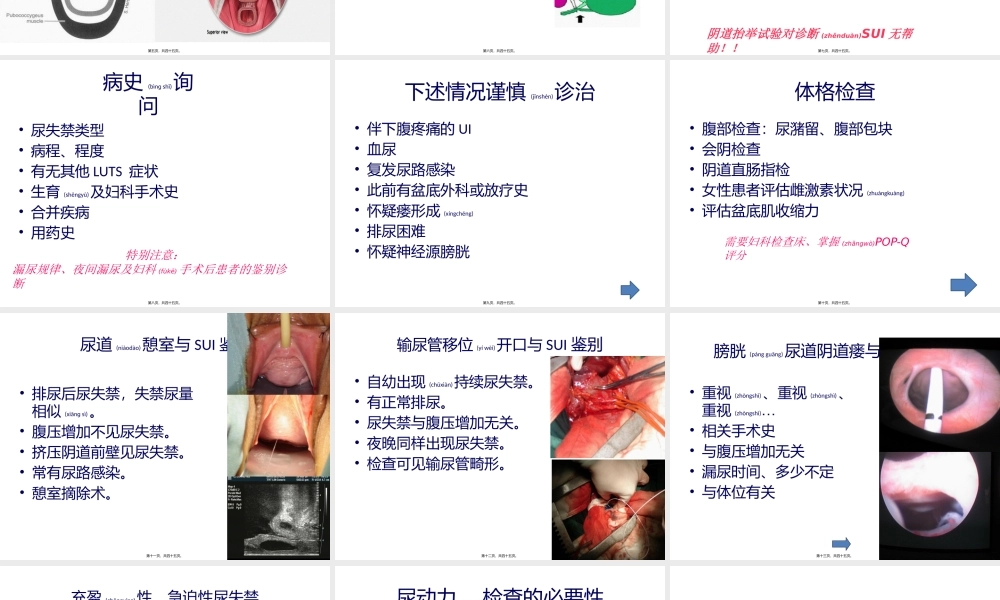 2022年医学专题—女性压力性尿失禁(1).pptx