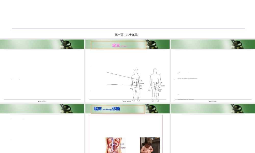 2022年医学专题—导管相关尿路感染(1).ppt