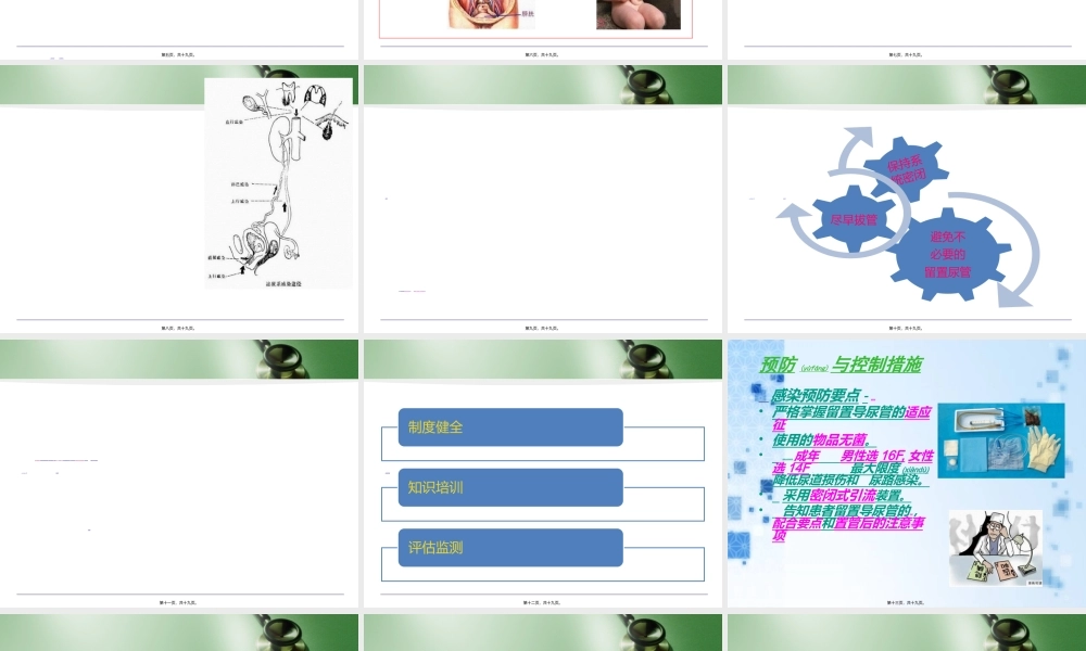 2022年医学专题—导管相关尿路感染(1).ppt