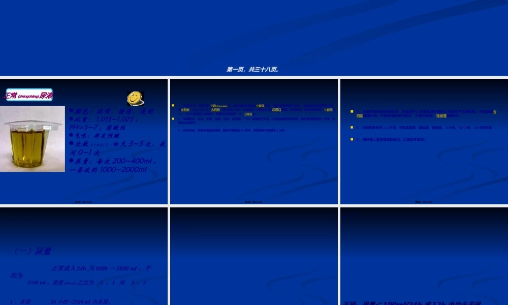 2022年医学专题—尿液检查(1).ppt