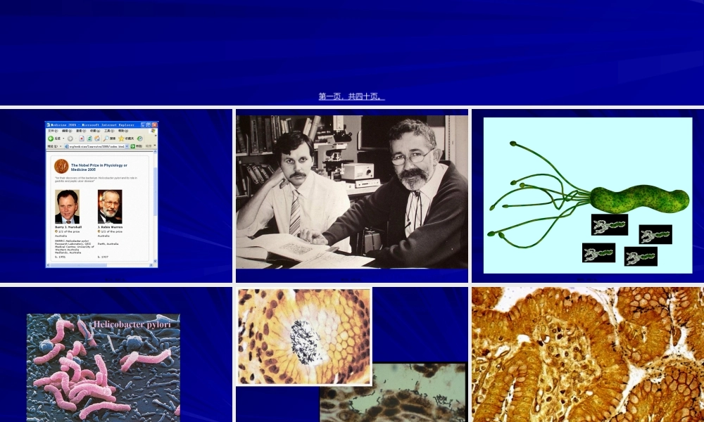 2022年医学专题—幽门螺杆菌感染的共识意见(1).ppt