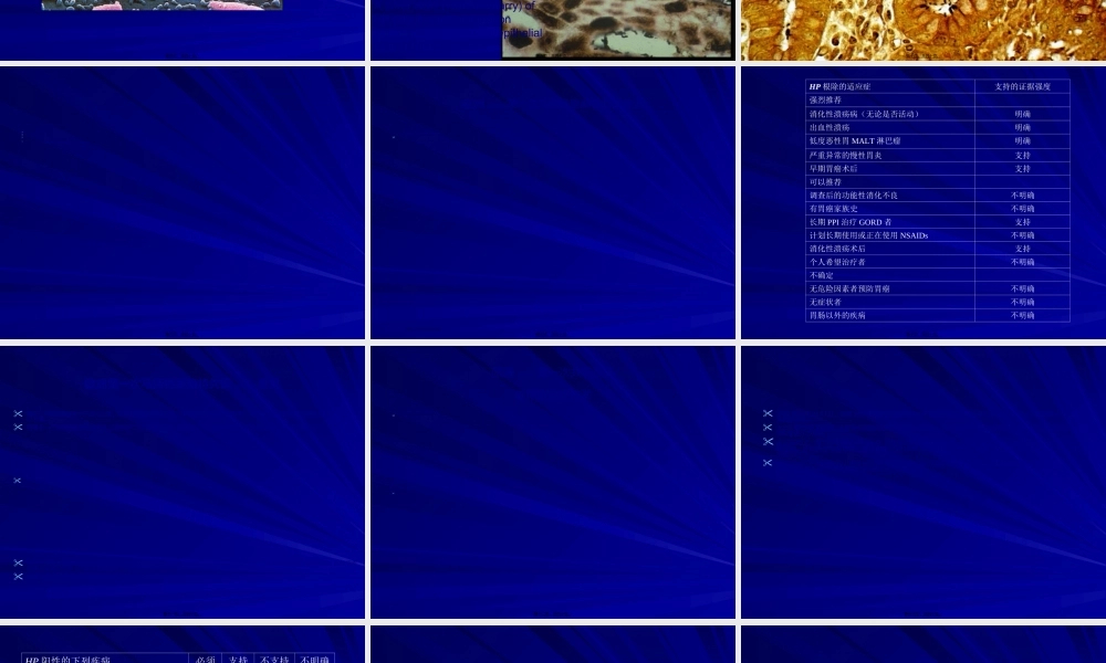 2022年医学专题—幽门螺杆菌感染的共识意见(1).ppt