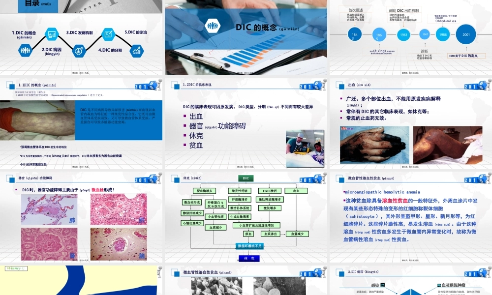 2022年医学专题—弥散性血管内凝血(1).pptx