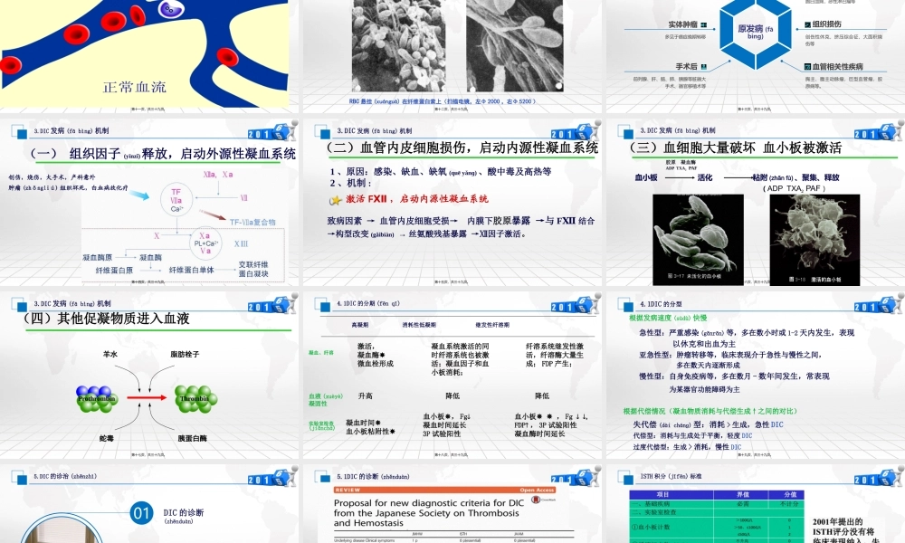 2022年医学专题—弥散性血管内凝血(1).pptx