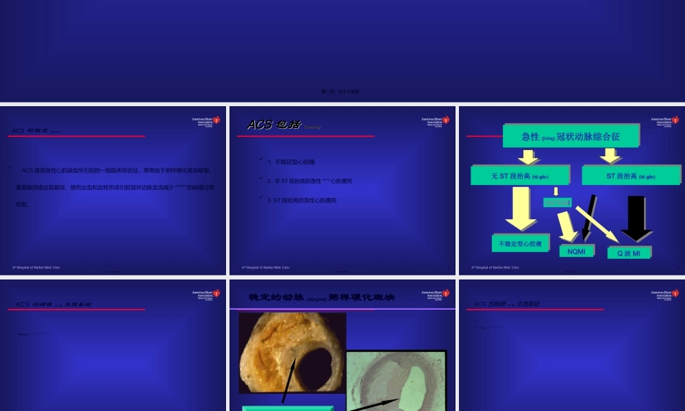 2022年医学专题—急性冠脉综合征现代诊治-洪志斌(1).ppt