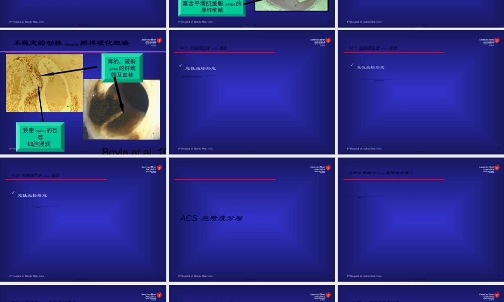 2022年医学专题—急性冠脉综合征现代诊治-洪志斌(1).ppt