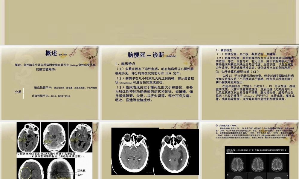2022年医学专题—急性脑卒中(1).ppt