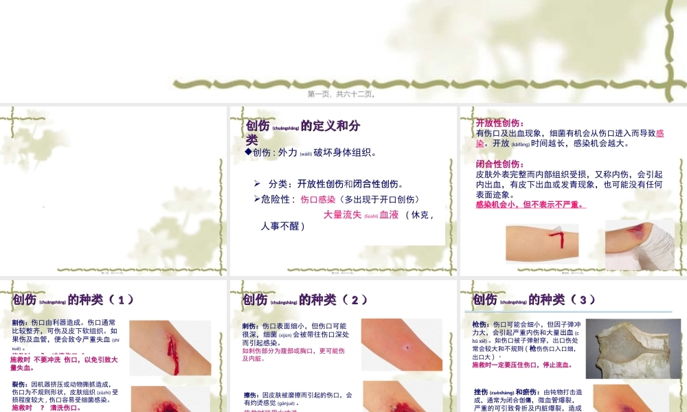 2022年医学专题—急救-创伤的识别及处理(1).ppt