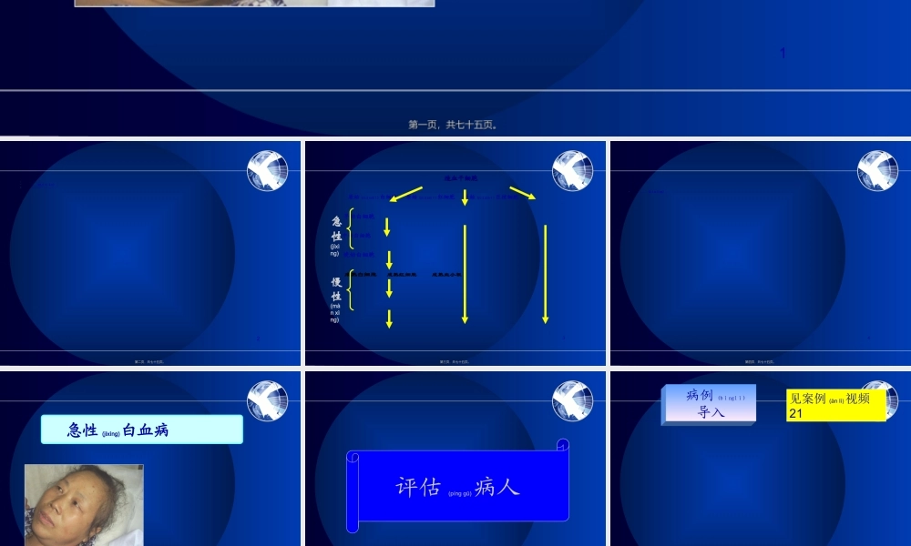 2022年医学专题—慢性淋巴细胞白血病(1).ppt