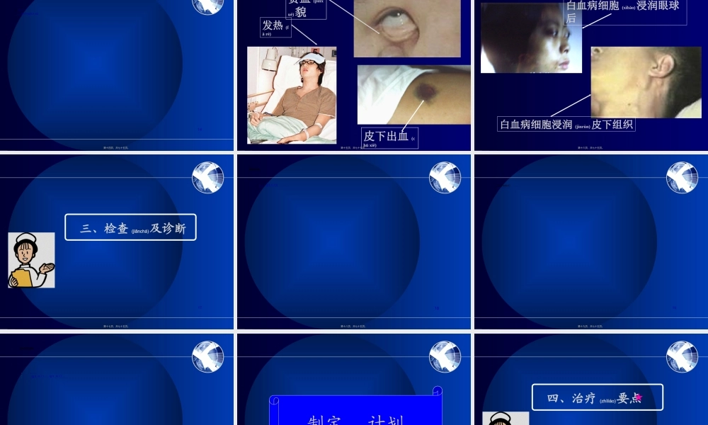 2022年医学专题—慢性淋巴细胞白血病(1).ppt