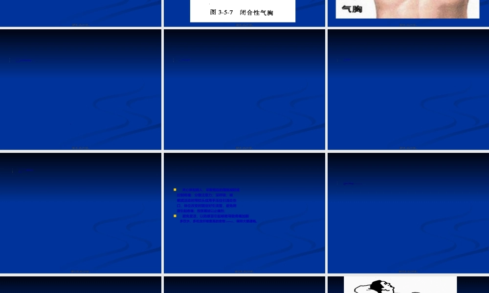 2022年医学专题—慢阻肺合并自发性气胸汇编(1).ppt