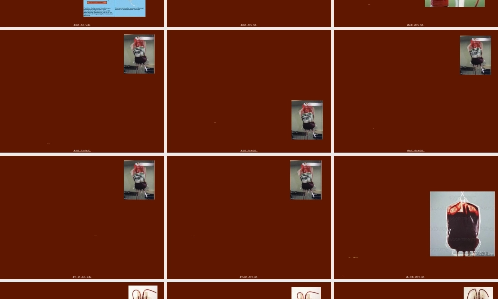 2022年医学专题—成分输血在儿科的应用(1).ppt