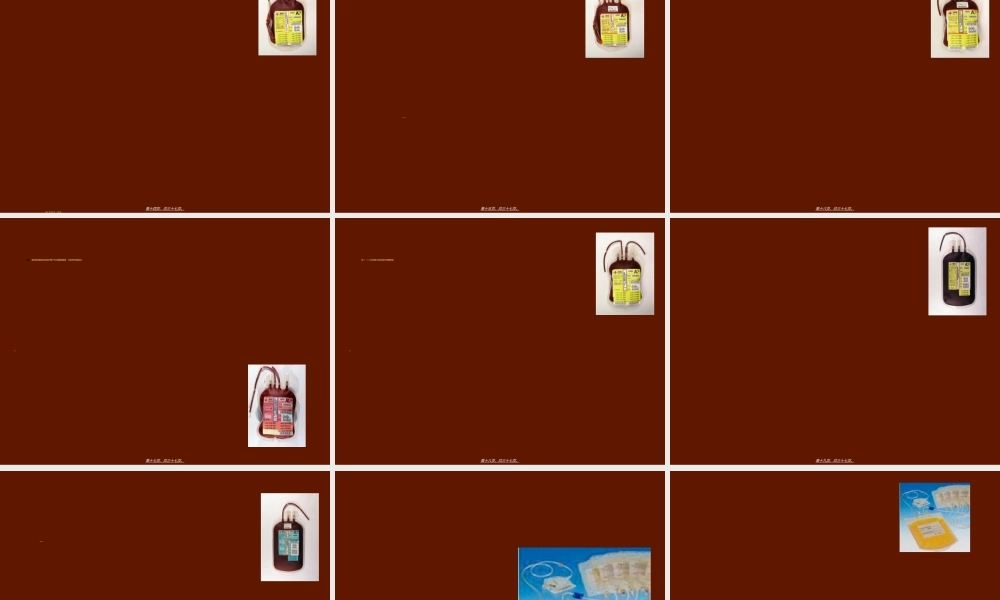 2022年医学专题—成分输血在儿科的应用(1).ppt