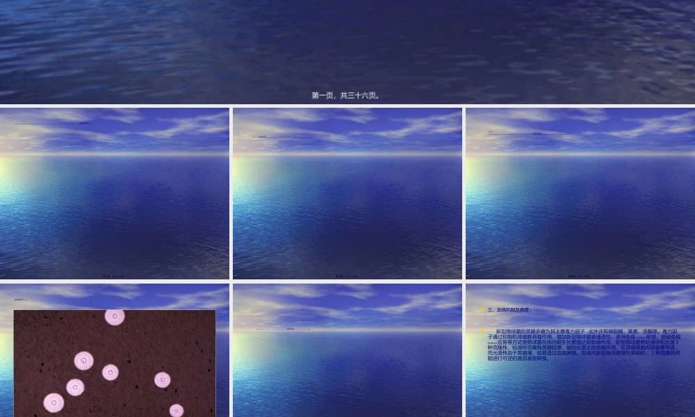 2022年医学专题—新型隐球菌-南宁第四人民医院(1).ppt