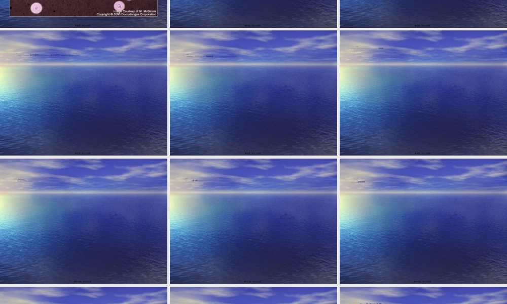 2022年医学专题—新型隐球菌-南宁第四人民医院(1).ppt