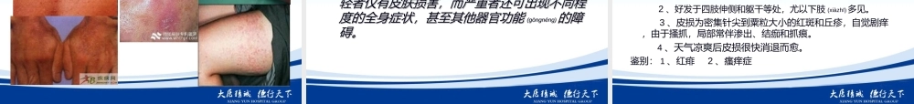 2022年医学专题—新夏季常见皮肤病--毛虎(1).ppt