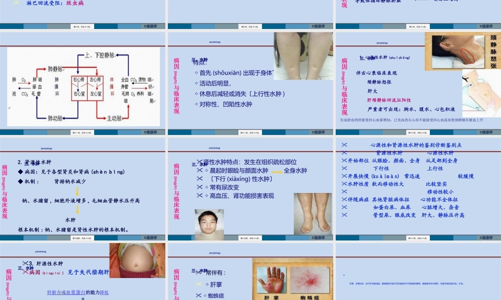 2022年医学专题—水肿脱水新(1).ppt