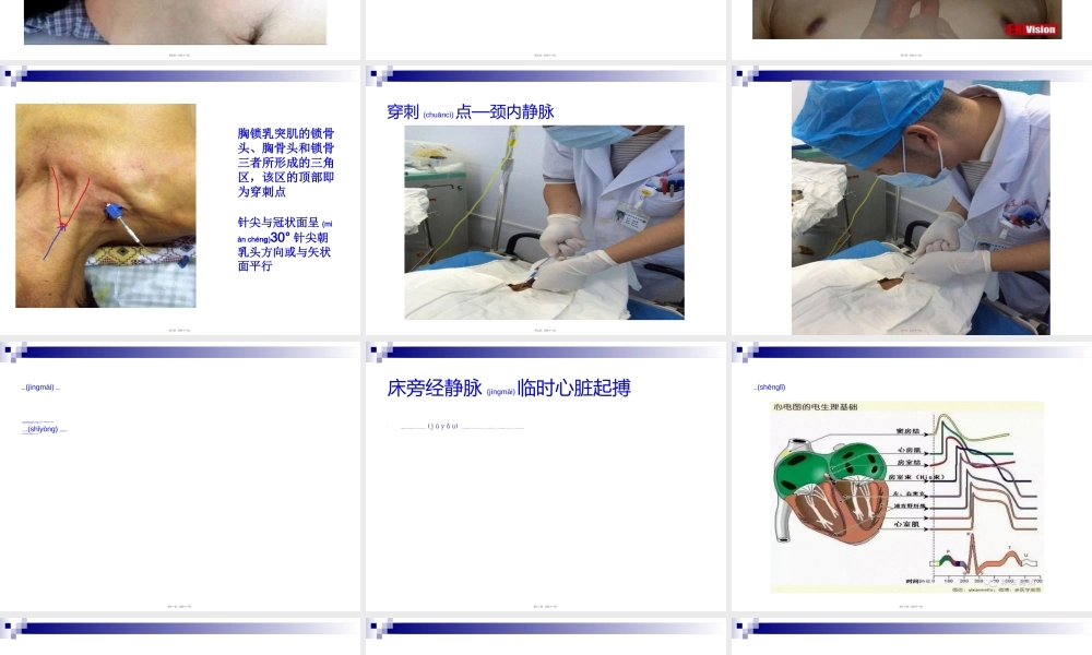 2022年医学专题—深静脉置管、临时心脏起搏(1).ppt