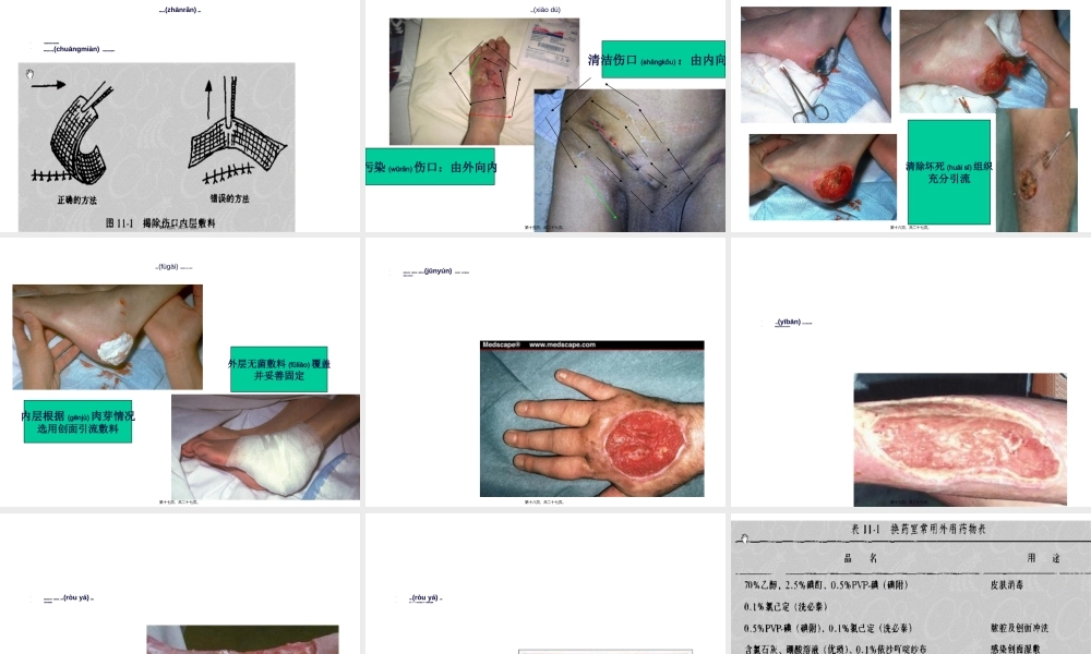 2022年医学专题—清创术与换药术ppt-清创术与换药术(1).ppt
