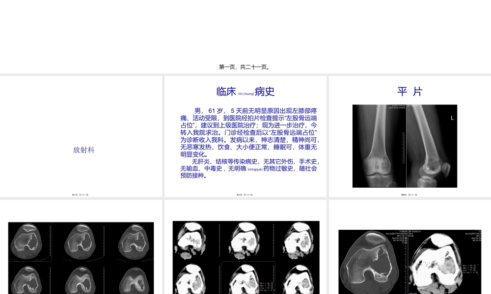 2022年医学专题—病例一(1).pptx