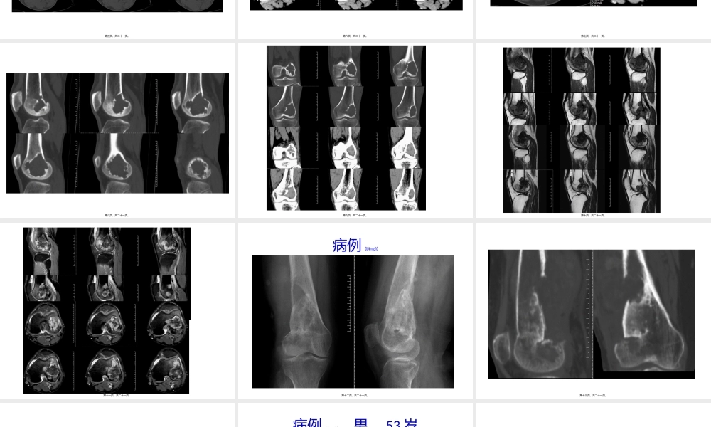2022年医学专题—病例一(1).pptx