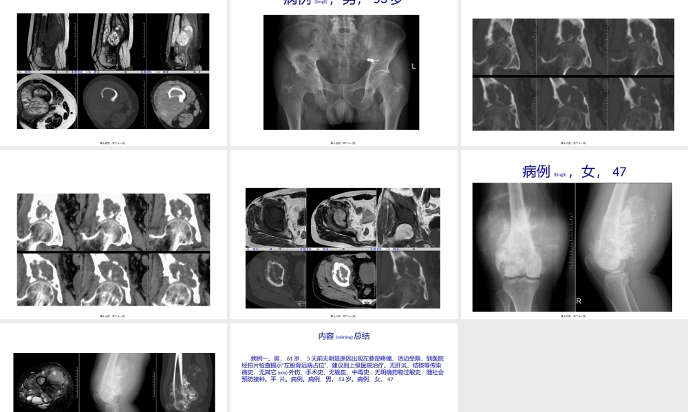 2022年医学专题—病例一(1).pptx