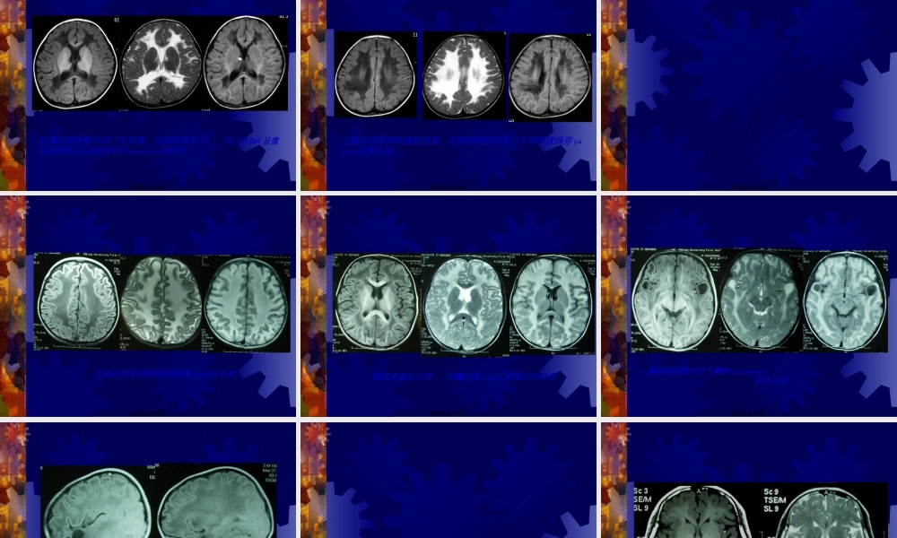 2022年医学专题—病例讨论2010.03.04示例图(1).ppt
