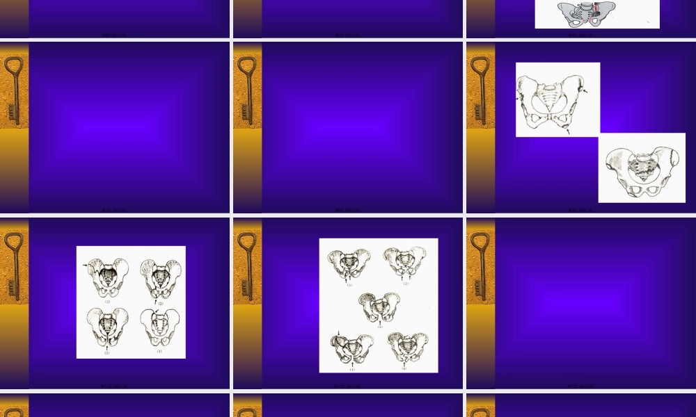 2022年医学专题—第65讲-骨盆骨折重点(1).ppt