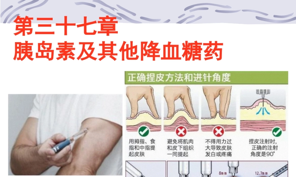 2022年医学专题—第三十七章-胰岛素与口服降血糖药(1).pptx