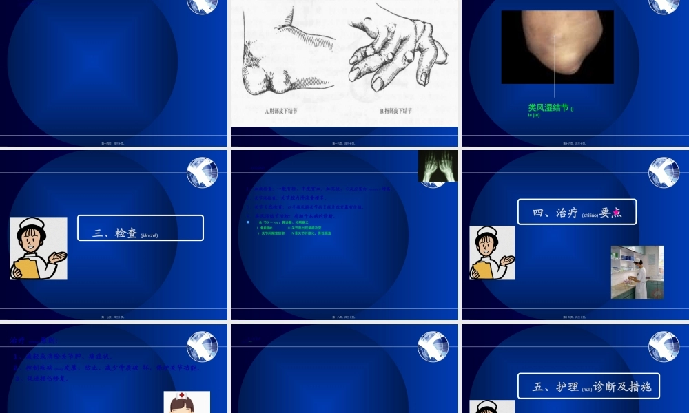 2022年医学专题—第三节-类风湿性关节炎(1).ppt